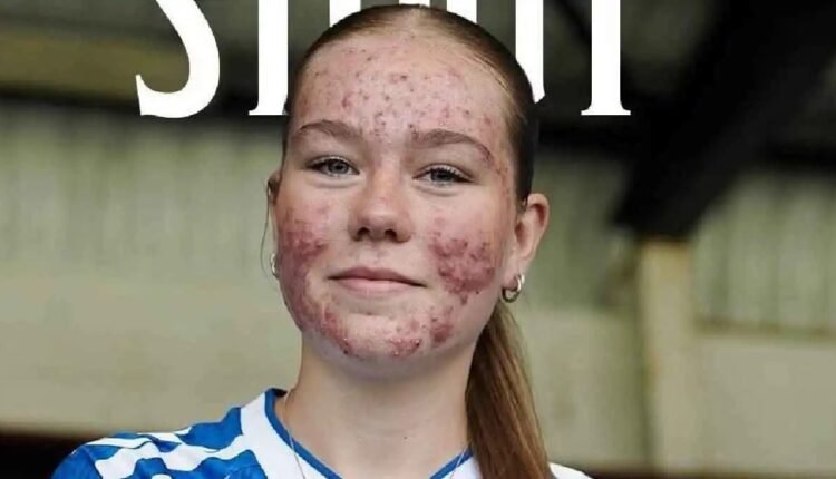 تنمر إلكتروني يطال اللاعبة البريطانية الشابة سكاي ستاوت